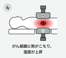 がん組織に熱がこもり、温度が上昇