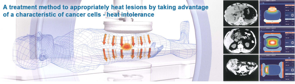 A treatment method to appropriately heat lesions by taking advantage of a characteristic of cancer cells - heat intolerance 